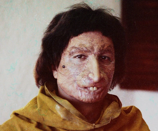 Jacques Gastineau - makeup effect on the actor Christian Clavier in the movie les visiteurs 1993